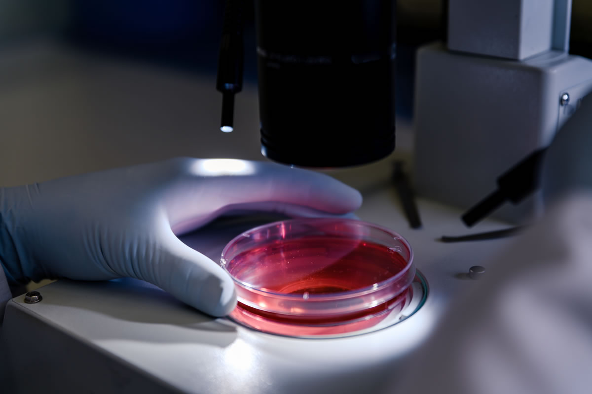 Laboratory analysis for Pseudomonas aeruginosa